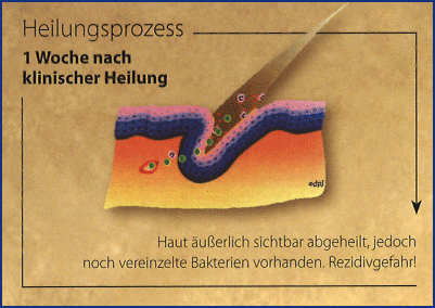 eine-Woche-nach-Heilung.png